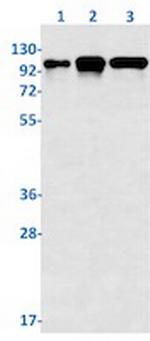 STAT6 Antibody in Western Blot (WB)