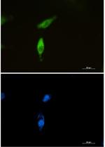 SQSTM1 Recombinant Rabbit Monoclonal Antibody