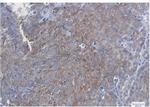 SQSTM1 Antibody in Immunohistochemistry (Paraffin) (IHC (P))