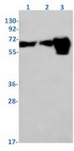 SQSTM1 Antibody in Western Blot (WB)