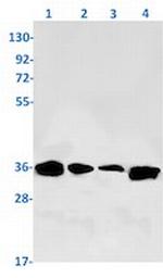 SPON2 Recombinant Rabbit Monoclonal Antibody