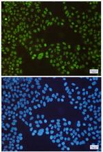 SP1 Recombinant Rabbit Monoclonal Antibody