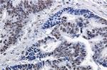 SP1 Antibody in Immunohistochemistry (Paraffin) (IHC (P))