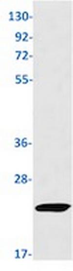 SOCS2 Recombinant Rabbit Monoclonal Antibody