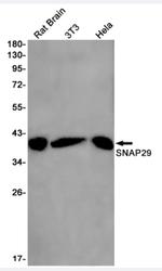 SNAP29 Antibody in Western Blot (WB)