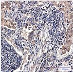 SMYD3 Antibody in Immunohistochemistry (Paraffin) (IHC (P))