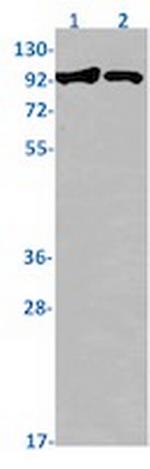 SLCO5A1 Recombinant Rabbit Monoclonal Antibody