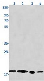 SKP1 Recombinant Rabbit Monoclonal Antibody