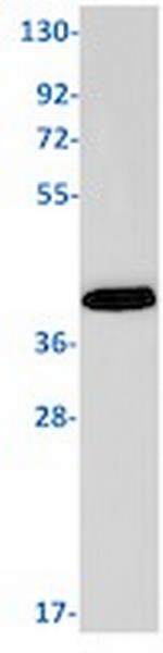 SIRT2 Recombinant Rabbit Monoclonal Antibody