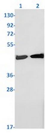 SET Recombinant Rabbit Monoclonal Antibody