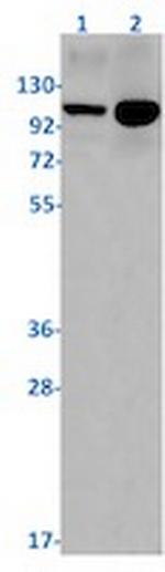 ATP2A2 Recombinant Rabbit Monoclonal Antibody