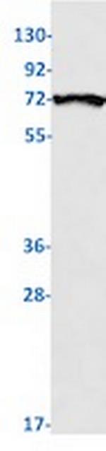 RPS6KB1 Recombinant Rabbit Monoclonal Antibody