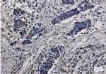 RPS6 Recombinant Rabbit Monoclonal Antibody