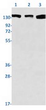 ROCK1 Antibody in Western Blot (WB)