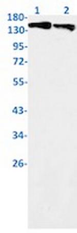 ROCK1 Antibody in Western Blot (WB)