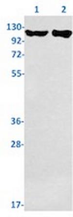 UPF1 Recombinant Rabbit Monoclonal Antibody