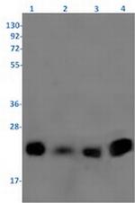 RLN2 Antibody in Western Blot (WB)