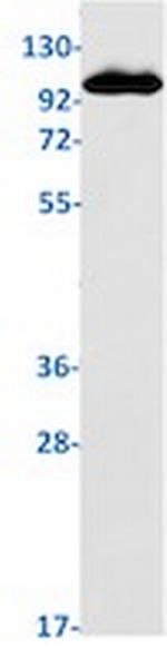 RB1 Recombinant Rabbit Monoclonal Antibody
