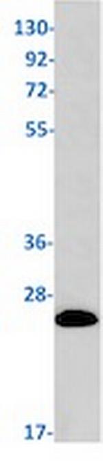RAB7B Antibody in Western Blot (WB)