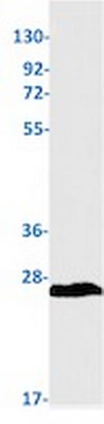 RAB7A Antibody in Western Blot (WB)