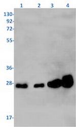 RAB7A Antibody in Western Blot (WB)