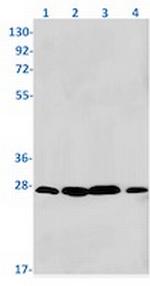 RAB5A Antibody in Western Blot (WB)