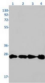 RAB5A Antibody in Western Blot (WB)