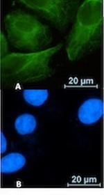 RAB10 Recombinant Rabbit Monoclonal Antibody