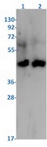 PDHA1 Antibody in Western Blot (WB)