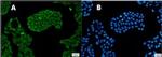 PSMC5 Recombinant Rabbit Monoclonal Antibody