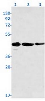 PRKAR1A Recombinant Rabbit Monoclonal Antibody