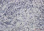 PPP2CA Recombinant Rabbit Monoclonal Antibody