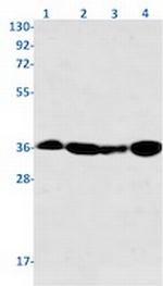 PPP2CA Antibody in Western Blot (WB)