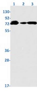 POT1 Recombinant Rabbit Monoclonal Antibody