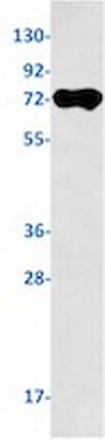 ALPP Recombinant Rabbit Monoclonal Antibody