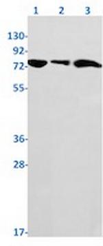 Prkcd Antibody in Western Blot (WB)