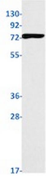 PRKCB Antibody in Western Blot (WB)
