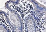 PRKCA Antibody in Immunohistochemistry (Paraffin) (IHC (P))
