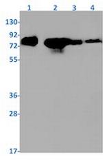 PRKCA Antibody in Western Blot (WB)