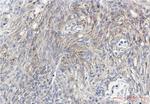 Phospho-PRKCG (Thr514) Recombinant Rabbit Monoclonal Antibody