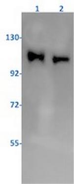 PIK3CB Recombinant Rabbit Monoclonal Antibody