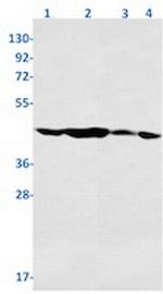PGK1 Recombinant Rabbit Monoclonal Antibody