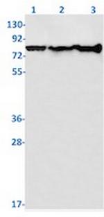 PFKP Antibody in Western Blot (WB)