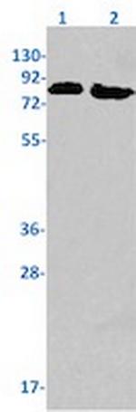 PFKL Recombinant Rabbit Monoclonal Antibody