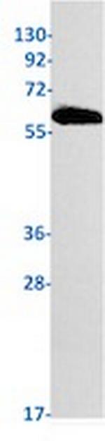 PFKFB3 Recombinant Rabbit Monoclonal Antibody