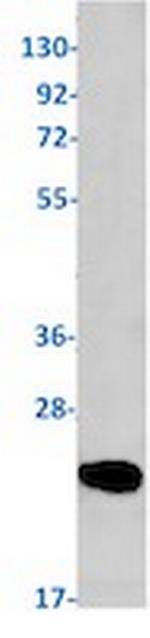 PRDX2 Antibody in Western Blot (WB)