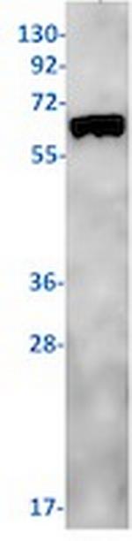 PDPK1 Recombinant Rabbit Monoclonal Antibody
