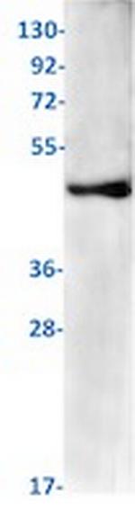 PDK2 Recombinant Rabbit Monoclonal Antibody
