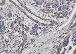 CDH1/CDH2/CDH3 Recombinant Rabbit Monoclonal Antibody