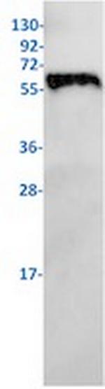 PAK1 Antibody in Western Blot (WB)